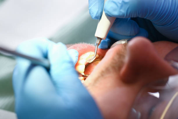 Best Emergency Cosmetic Dentistry (e.g., broken veneers) in Villas, FL